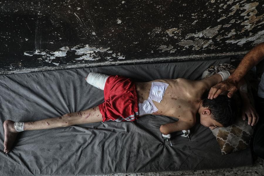 ชีวิตพิการของ 'เด็กปาเลสไตน์' จากการโจมตีของอิสราเอล