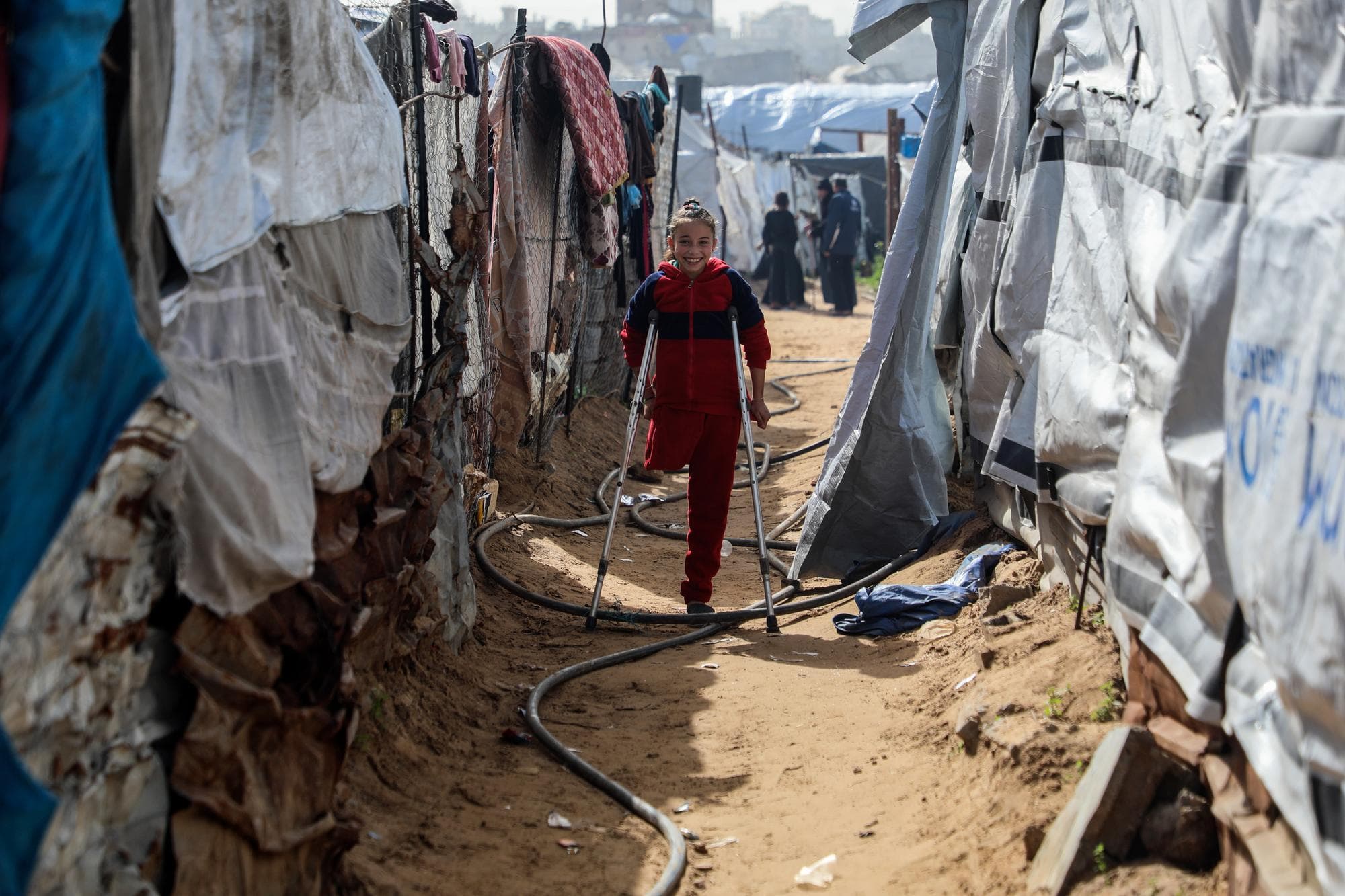 มาลัก คาเดอร์ เด็กหญิงผู้สูญเสียขา-ครอบครัวจากสงครามในกาซา