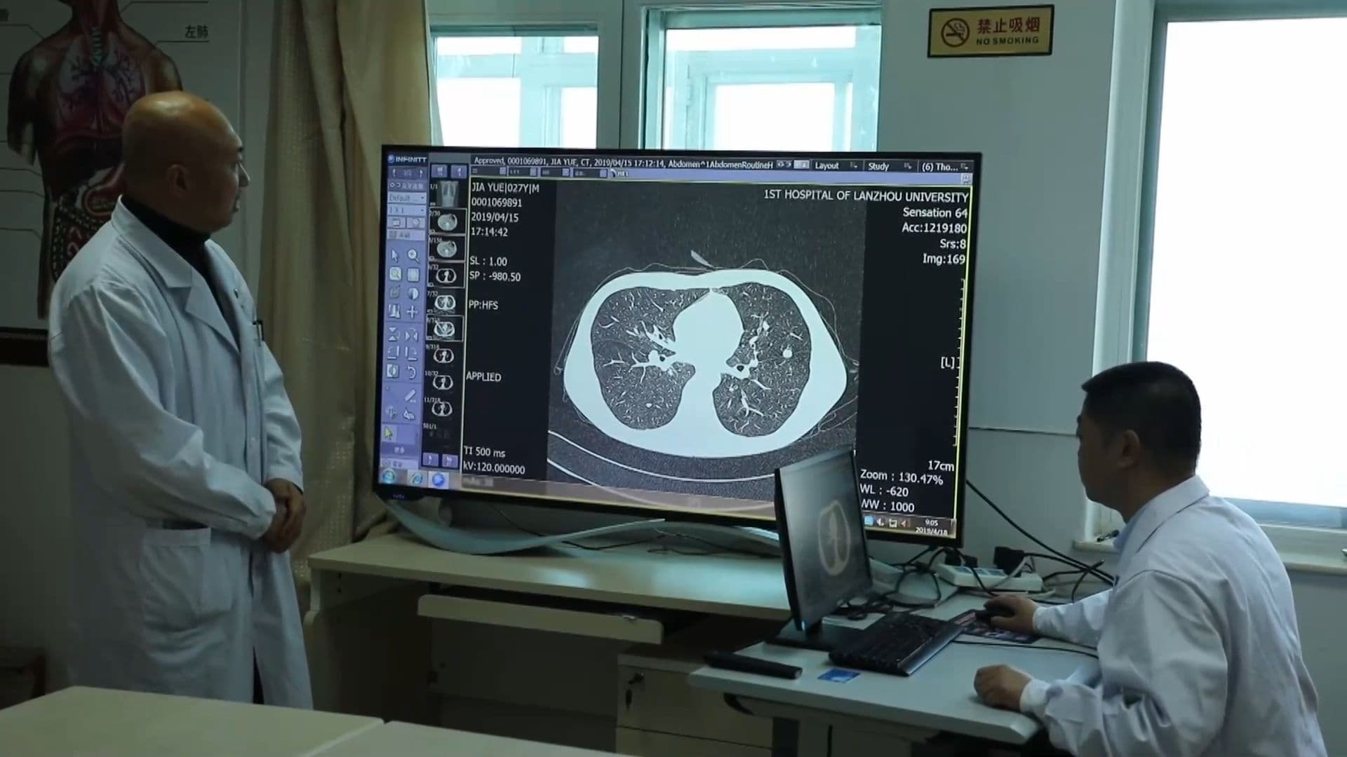 หมอ AI ช่วยวินิจฉัยโรคในกานซู่ สกัดมะเร็งปอด-มะเร็งตับอ่อนคร่าชีวิต